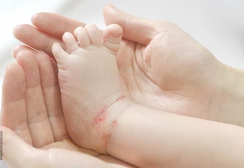 problemas de piel en bebes