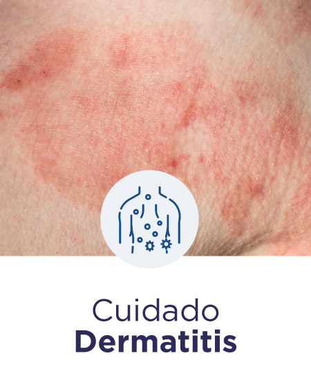 cuidado piel dermatitis